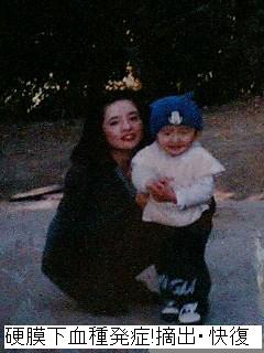 血腫摘出Ope際、丸坊主・・・帽子着用♪